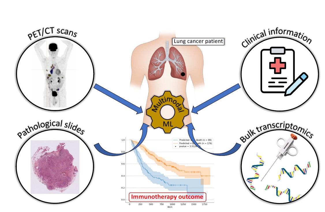 Schéma sur l'avancé des soins disponibles pour le cancer des poumons